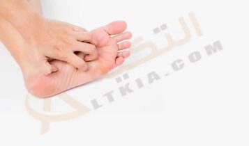 علاج حكة باطن القدم بالأعشاب