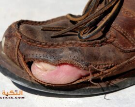 تفسير رؤية تمزق الحذاء في المنام